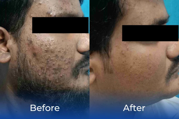 hair treatment specialist